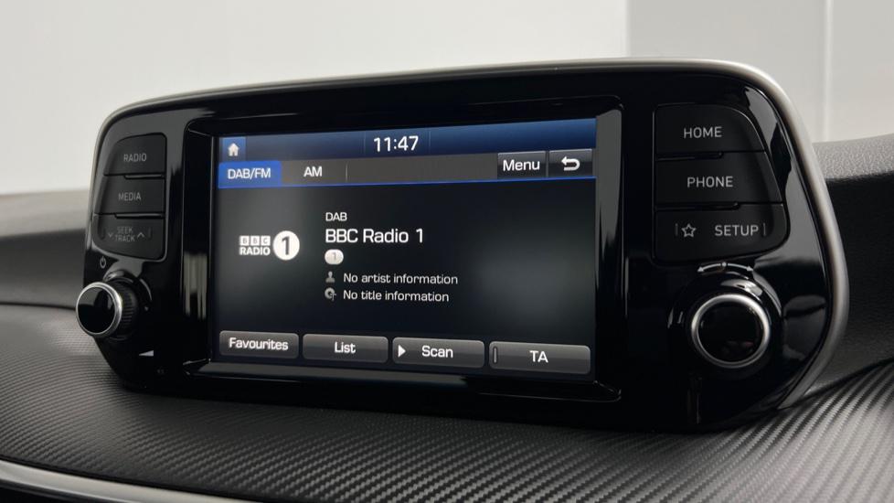 DAB Radio