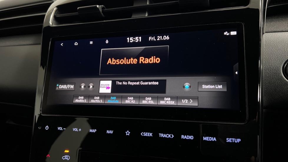 DAB Radio