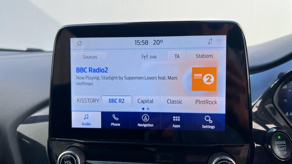 DAB Radio