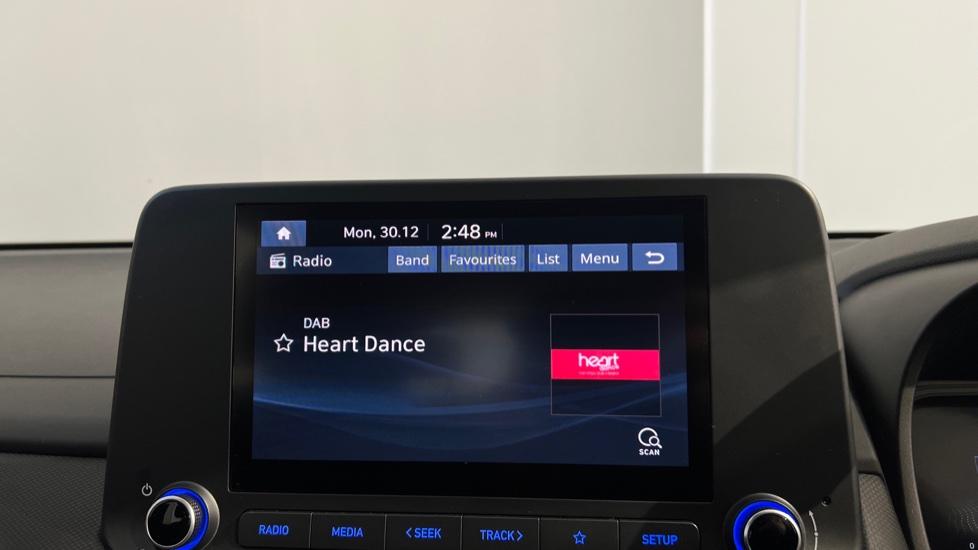 DAB Radio