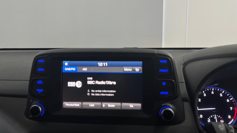 DAB Radio