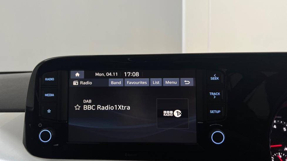 DAB Radio