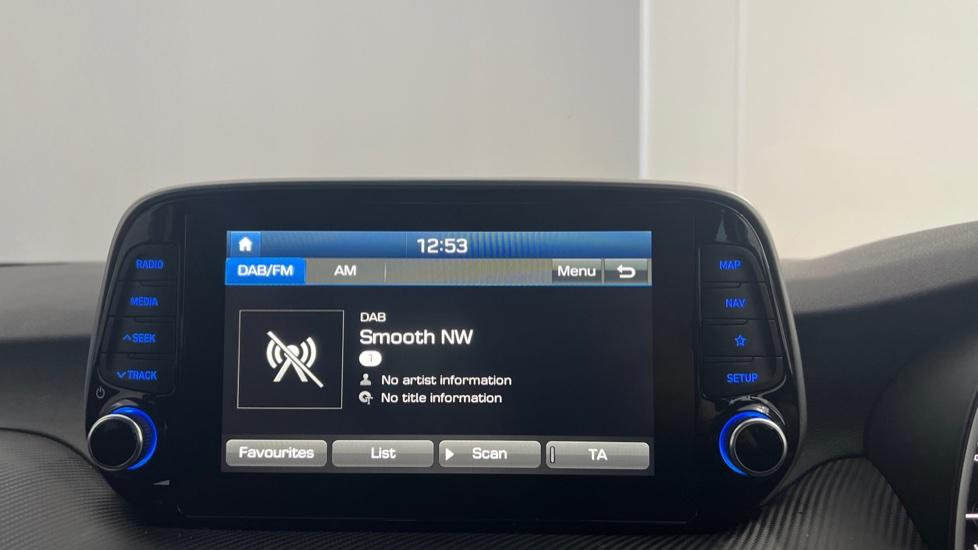 DAB Radio