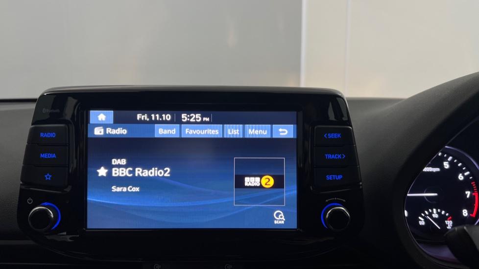 DAB Radio