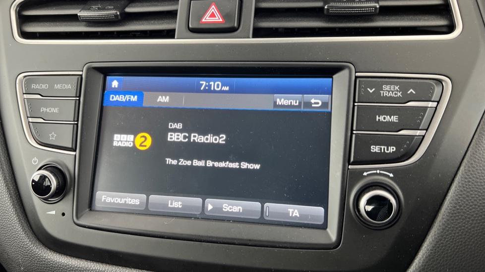 DAB Radio