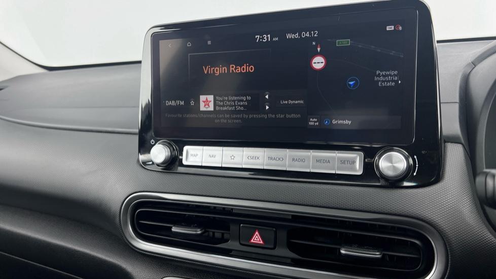 DAB Radio