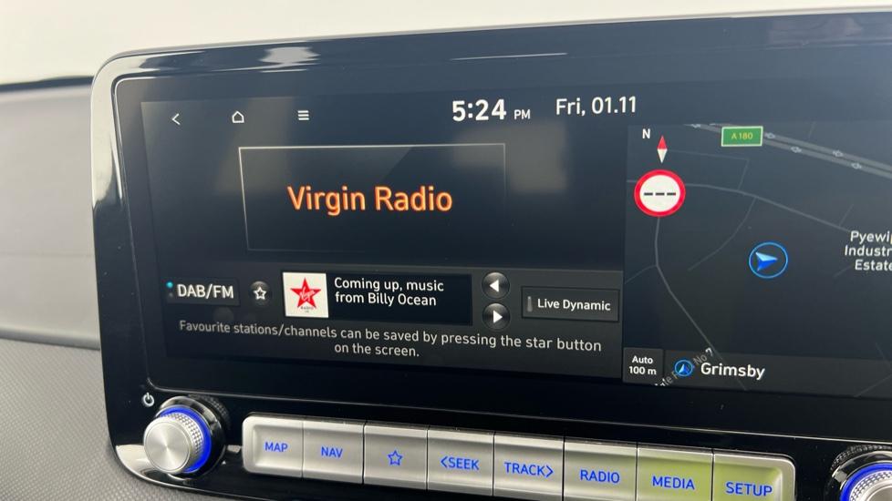 DAB Radio