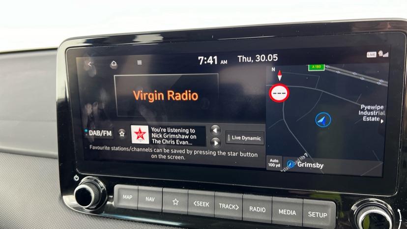 DAB Radio