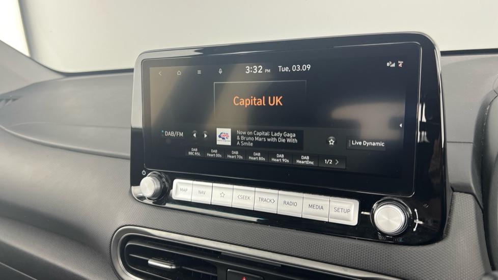 DAB Radio