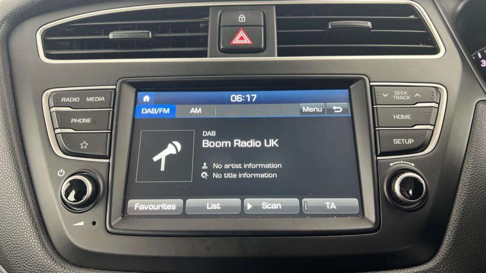 DAB Radio