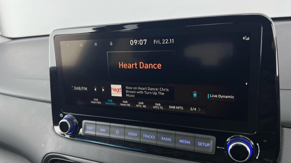 DAB Radio