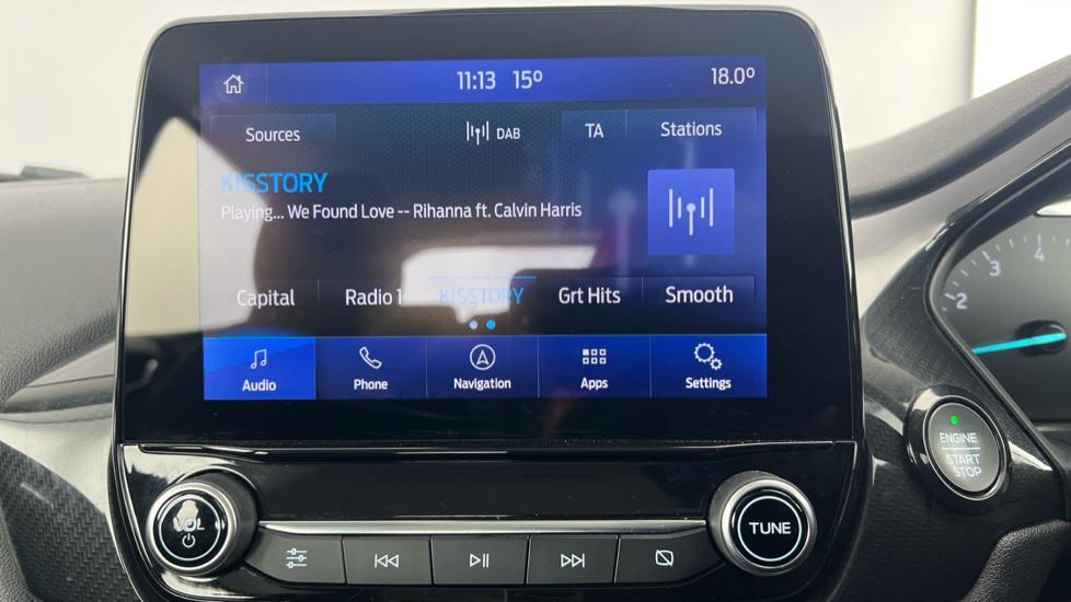 DAB Radio