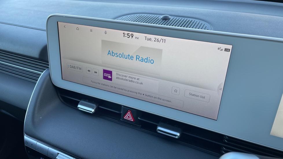 DAB Radio