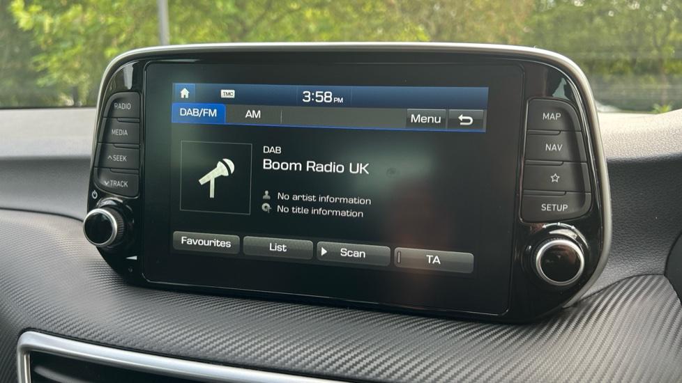 DAB Radio