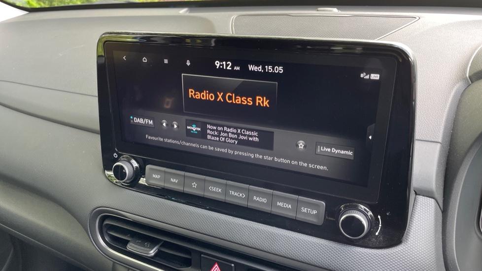 DAB Radio