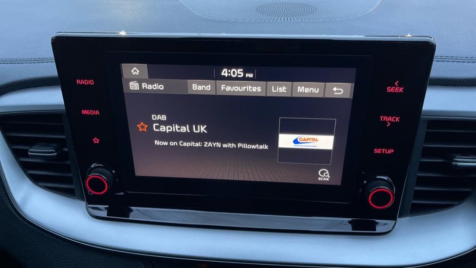 DAB Radio