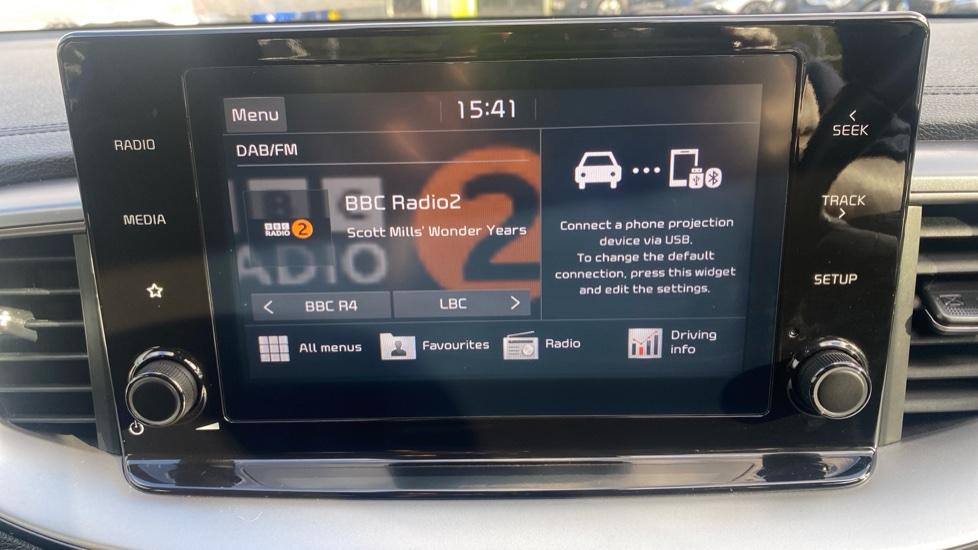 DAB Radio