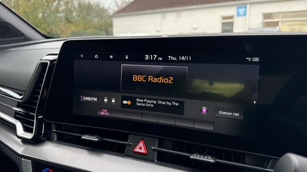 DAB Radio