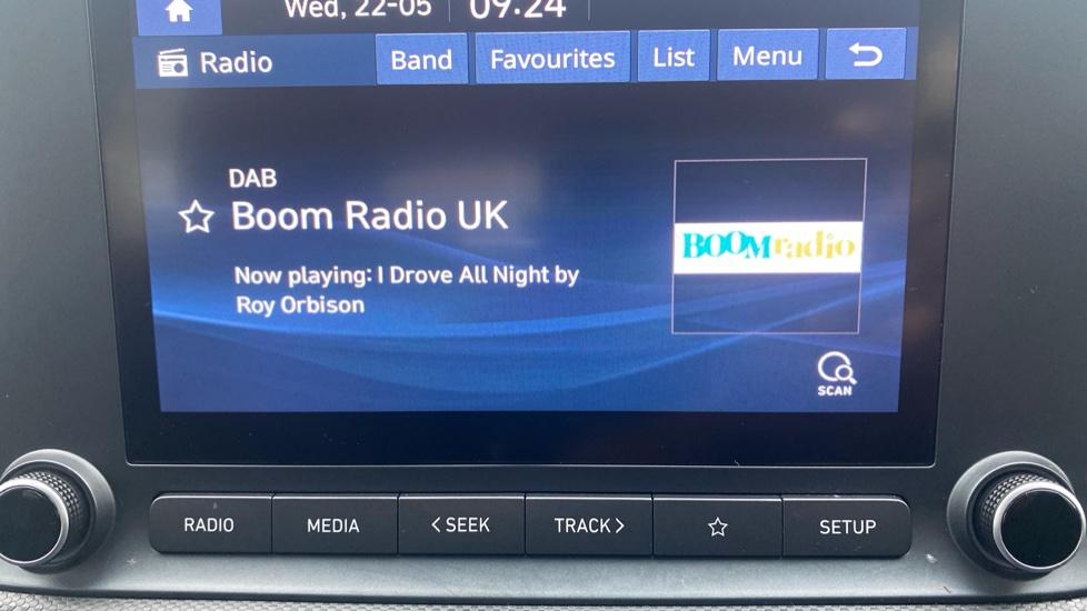 DAB Radio