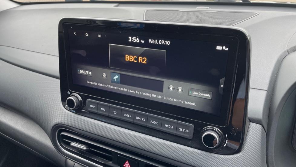 DAB Radio