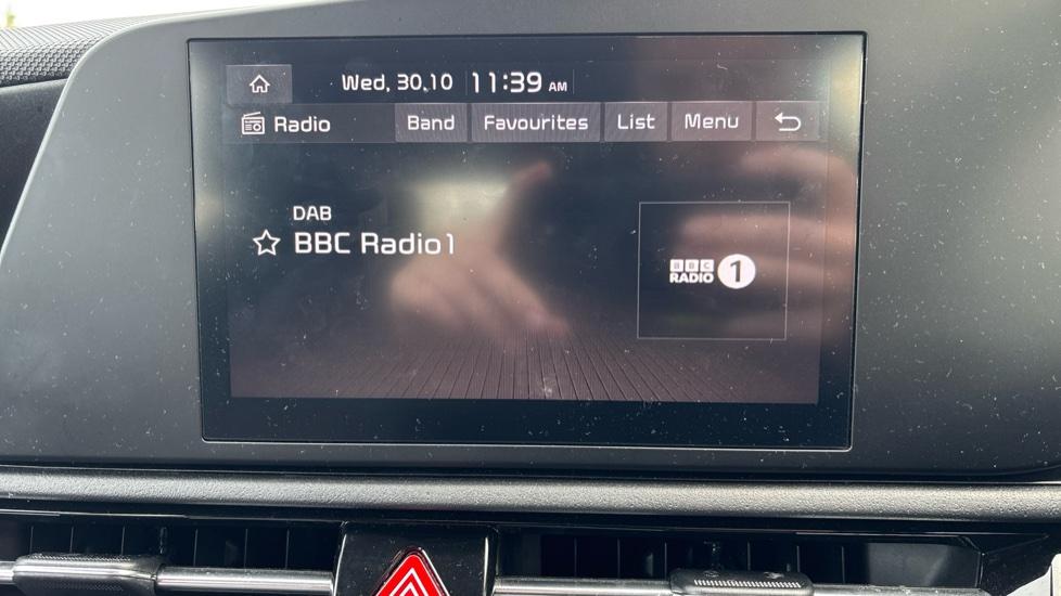 DAB Radio