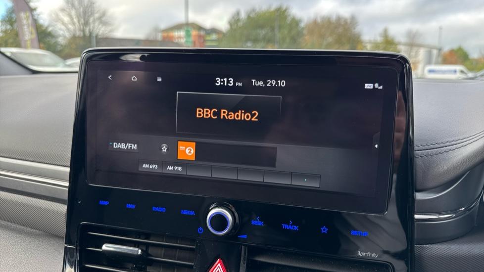 DAB Radio