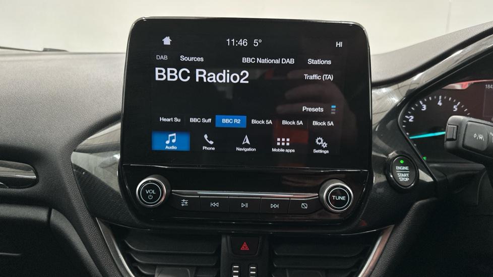 DAB Radio