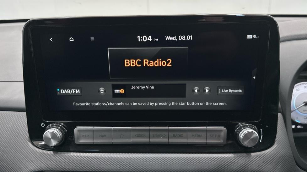 DAB Radio