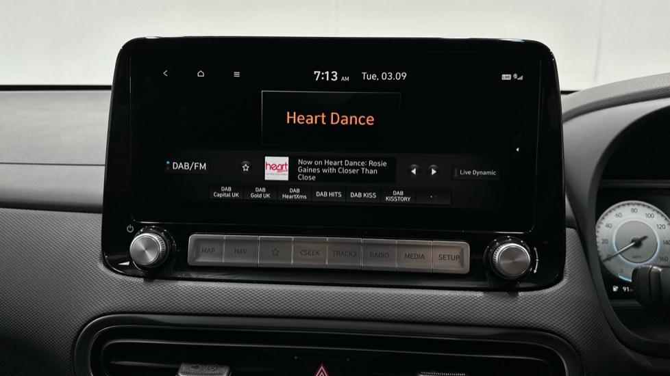 DAB Radio