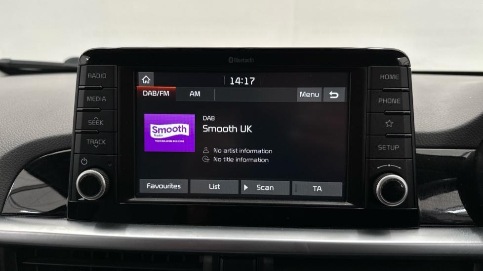 DAB Radio