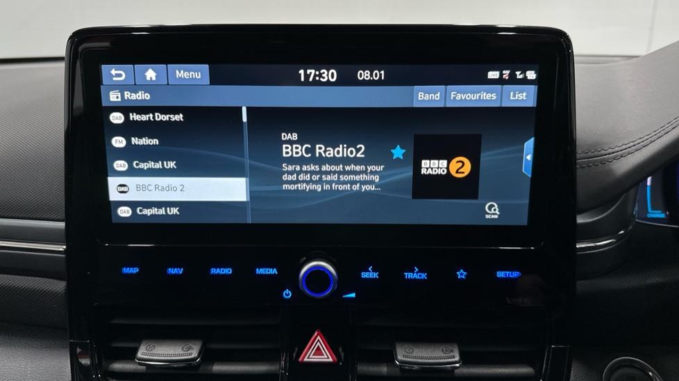 DAB Radio