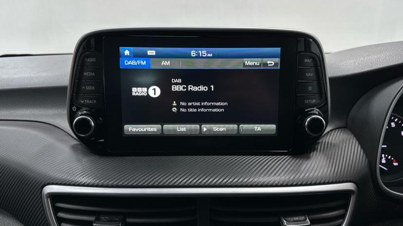 DAB Radio