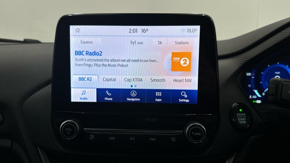 DAB Radio