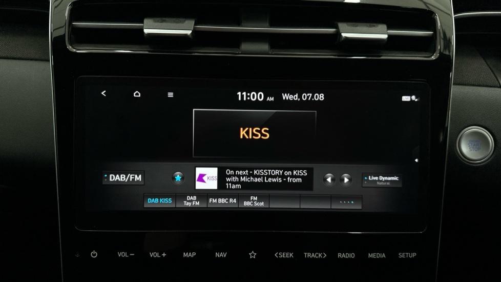 DAB Radio