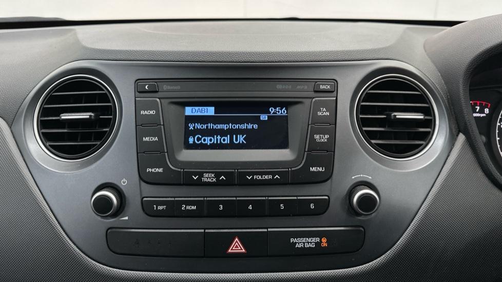 DAB Radio