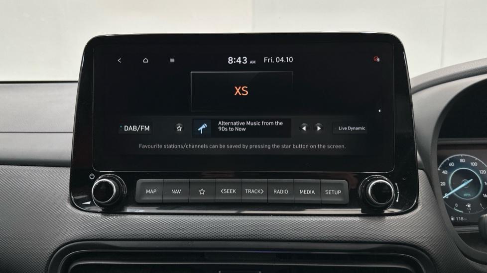 DAB Radio