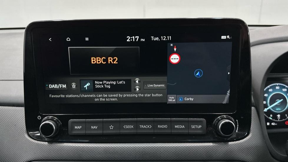 DAB Radio